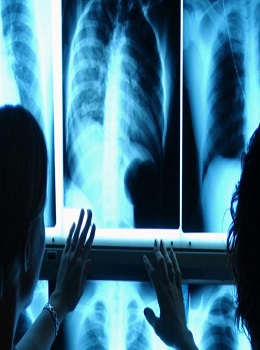 RADIOLOGIA HACIA LA LICENCIATURA EN BIOIMAGENOLOGIA